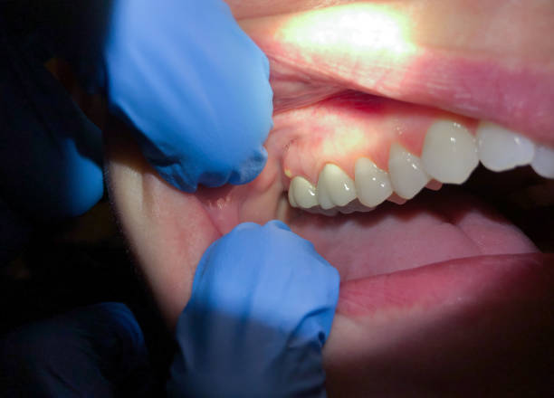 Best Pediatric Emergency Dentist in Cleveland, TX