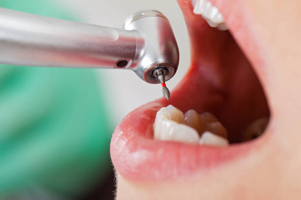 Best Pediatric Emergency Dentist in Cleveland, TX